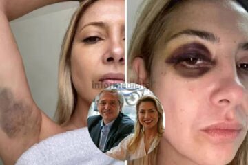 Recién aparecieron repercusiones entrerrianas por la denuncia por golpes de Fabiola a Alberto