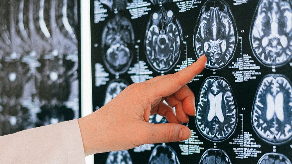 Neurocirujanos detienen atención a afiliados de Ioscor y reciben críticas por parte del Gobierno