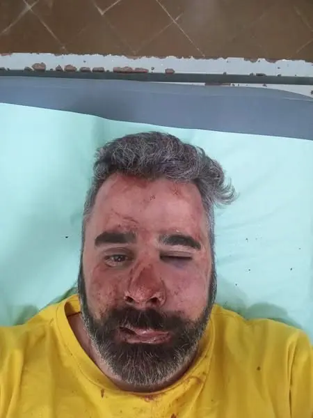 Brutal golpiza al presidente del Partido Libertario en Entre Ríos