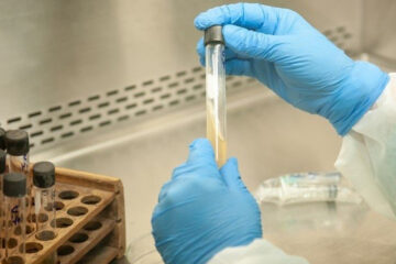 Coronavirus: 5 muertes y 103 nuevos casos suman 4783 infectados en el país (contagiados de Entre Ríos)